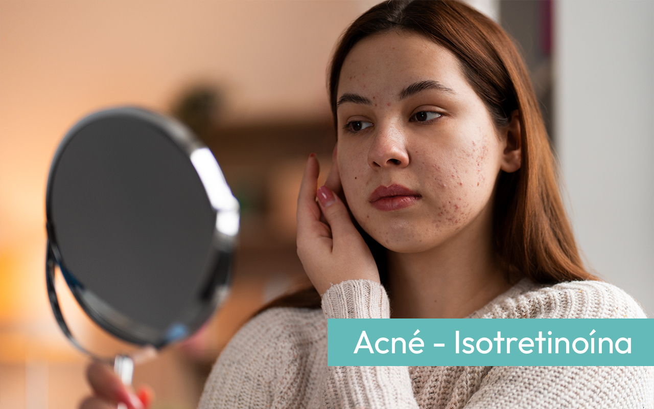 Isotretinoína en acné y nuevas indicaciones