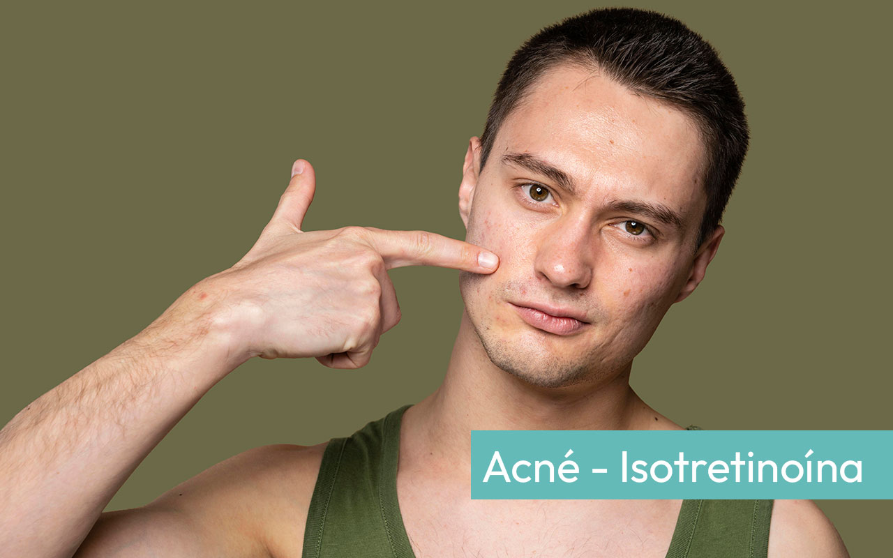 Isotretinoína en el tratamiento del acné y otras enfermedades dermatológicas